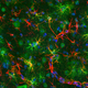 A mouse model of neurodegeneration, which is a hallmark feature of ALS.